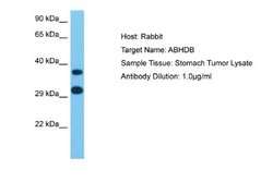 ABHD11 Antibody, Novus Biologicals 100 &mu;L | Buy Online | Novus Biologicals | Fisher Scientific